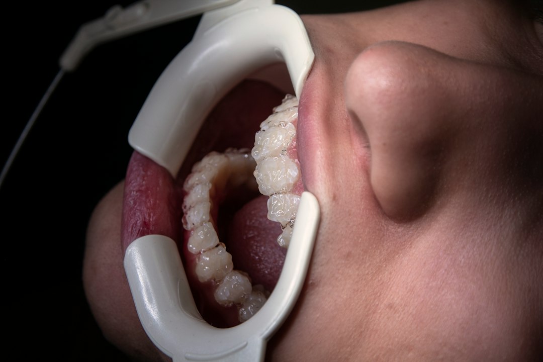Dental device in a patient's mouth