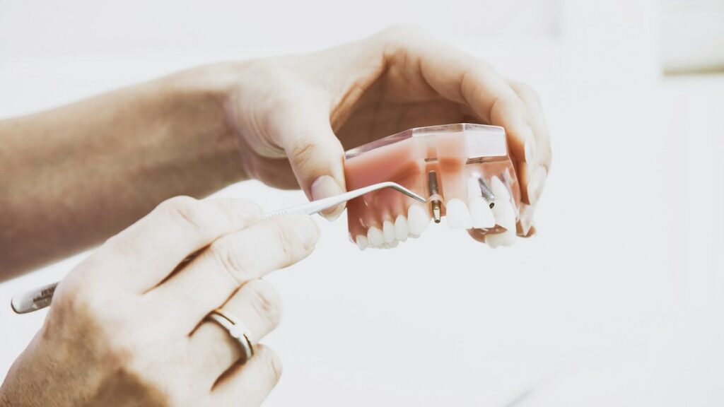 Dental model and oral care tools